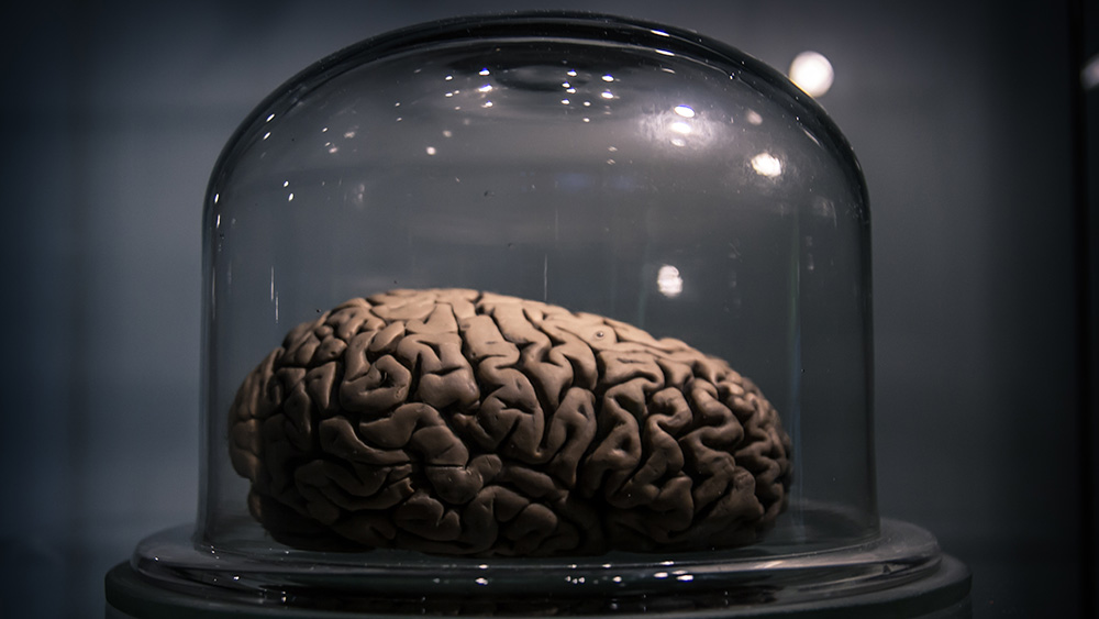 Kiszárított emberi agy a trentói Tudományos Múzeumban. Forrás: Flickr/Riccardo Meneghini