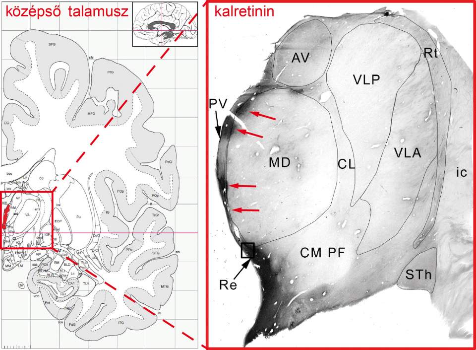 Balra az emberi agy féloldalas keresztmetszetének sematikus rajza, benne pirossal jelölve a középső talamusz kalretininsejtjei. Jobbra: kalretininsejtek (piros nyilak) az emberi talamusz középső részén