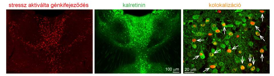 A stressz által kiváltott génkifejeződés (piros) kizárólag a kalretinin tartalmú idegsejtekre (zöld) korlátozódik (fehér nyilak a nagyított képen, jobbra)