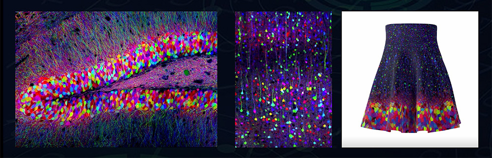A Brainbow nevű technológiával véletlenszerűen színezett neuronok - forrás: Hangya Balázs előadása