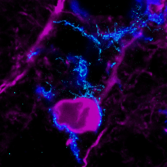Szuperrezolúciós mikroszkópiás eljárással készített felvétel, mely a mikroglia-idegsejt kapcsolatokban kiemelkedően fontos receptorok eloszlását mutatja egy neuronnal kapcsolódó mikrogliasejt felszínén - forrás: MTA KOKI/Orsolits Barbara