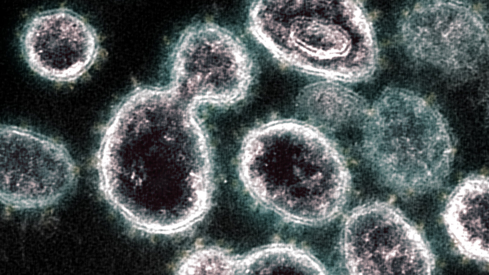 SARS-COV-2 koronavírus, transzmissziós elektronmikroszkópos felvétel, orrás: Flickr/NIH Image Gallery/NIAID-RML