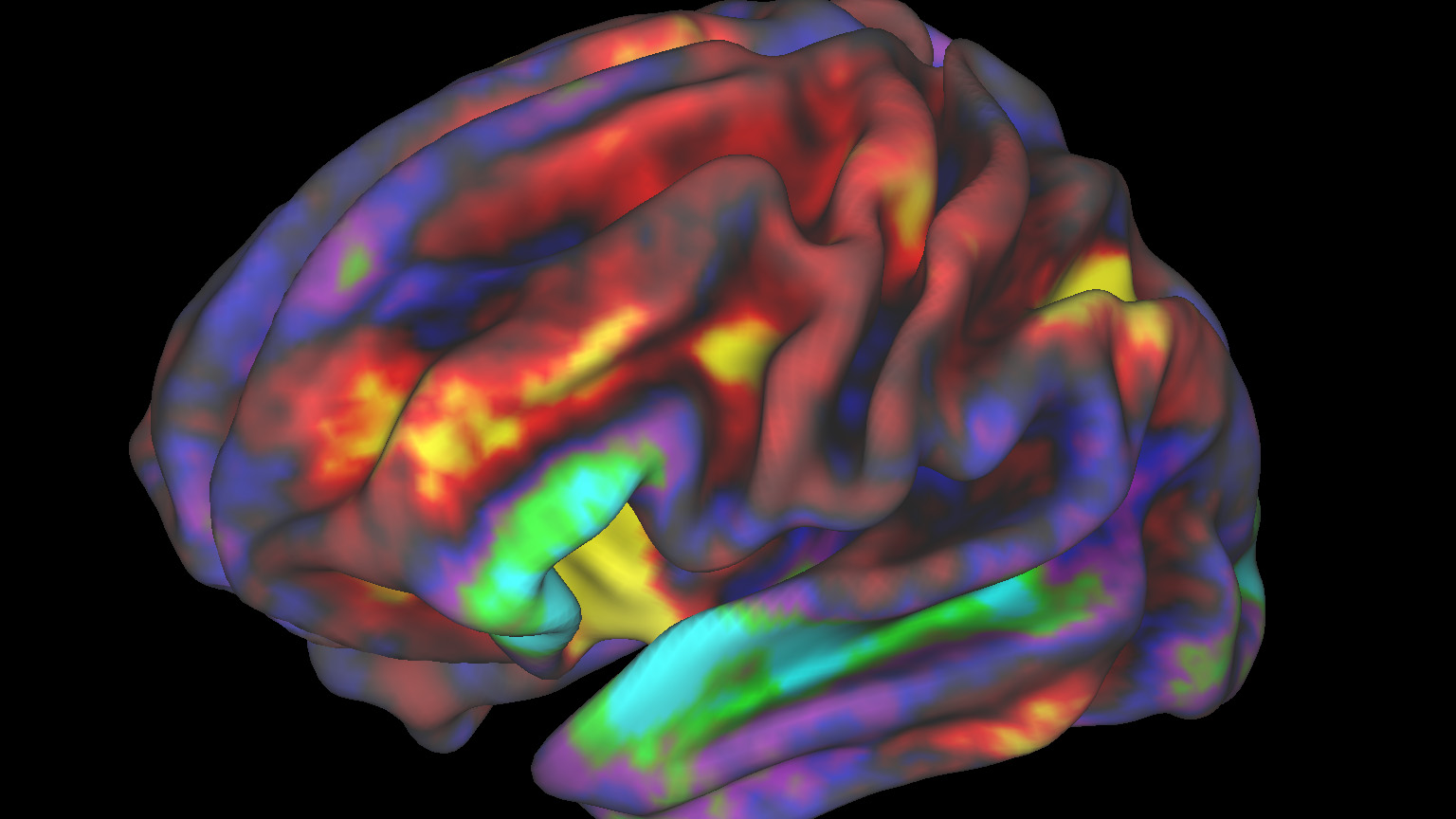 Gyerekagy fMRI, forrás: NIH Image Gallery/Richard Watts, PhD, University of Vermont and Fair Neuroimaging Lab, Oregon Health and Science University