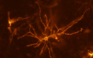 Egérneuron, striatum - forrás: Flickr/NIH Image Gallery/Veronica Alvarez, National Institutes of Health